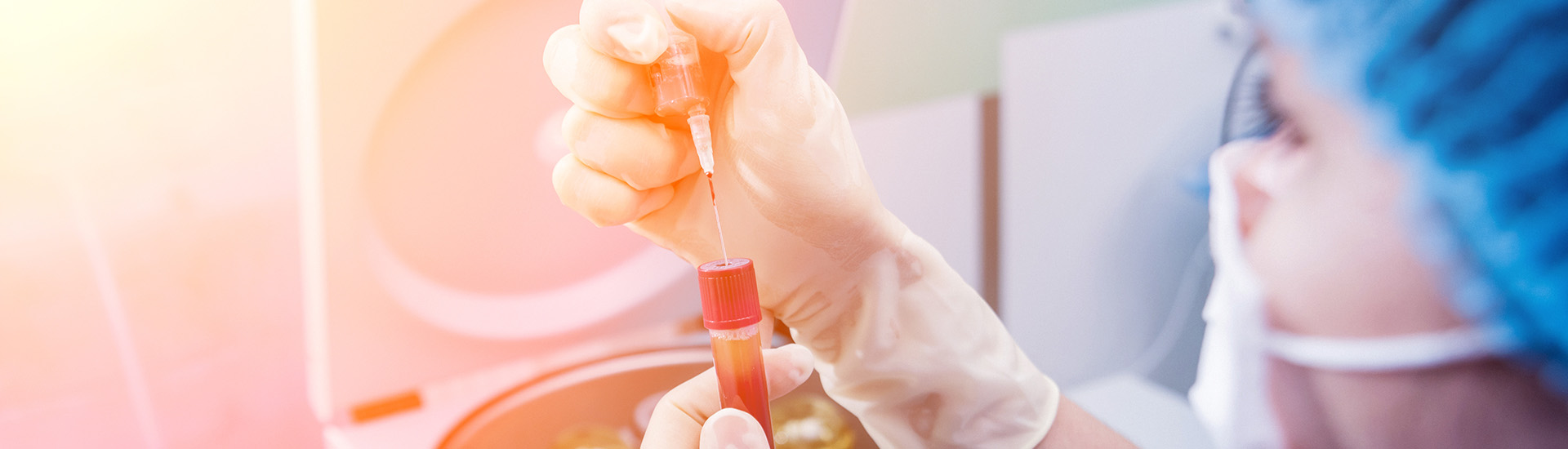 Patienteneigene Wachstumsfaktoren / PRP Friedberg